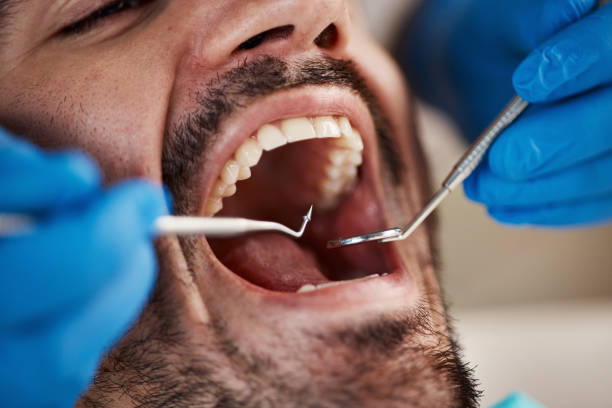 Best Emergency Broken Tooth Repair in Glasgow, VA