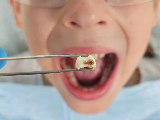 Best Emergency Dental Surgery in Glasgow, VA